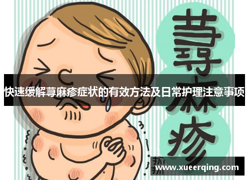 快速缓解荨麻疹症状的有效方法及日常护理注意事项